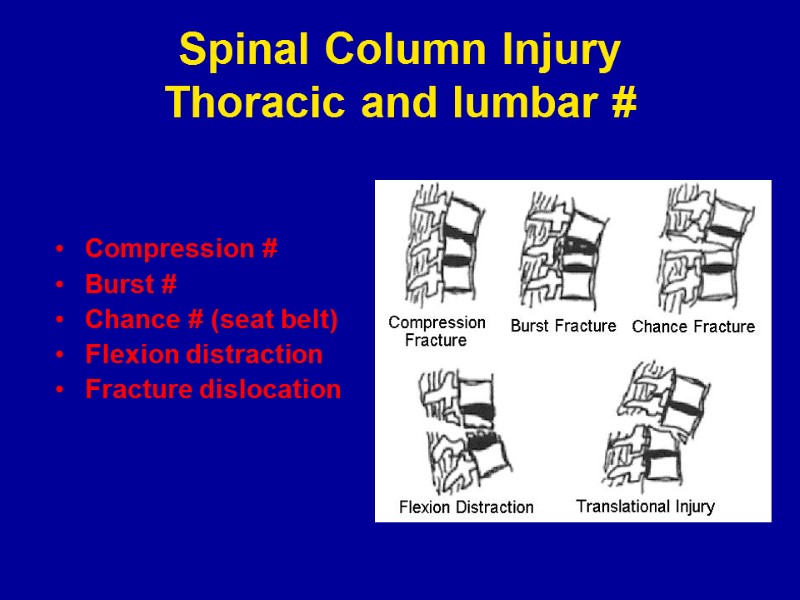 Spinal Column Injury Thoracic and lumbar # Compression # Burst # Chance # (seat